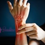 Why You Should Not Ignore Wrist Pain
