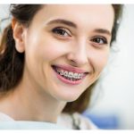 Guide to Orthodontics for Adults