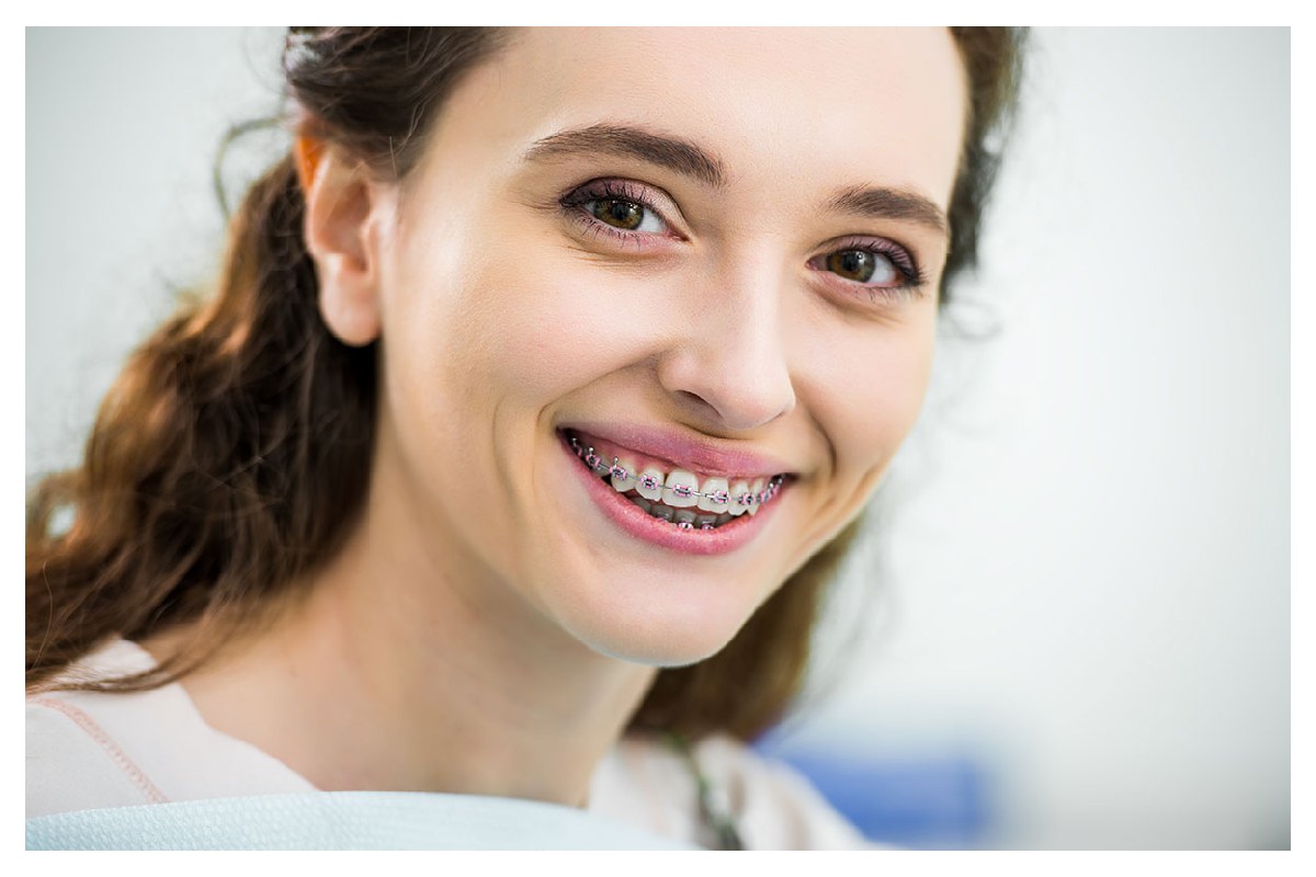 Guide to Orthodontics for Adults