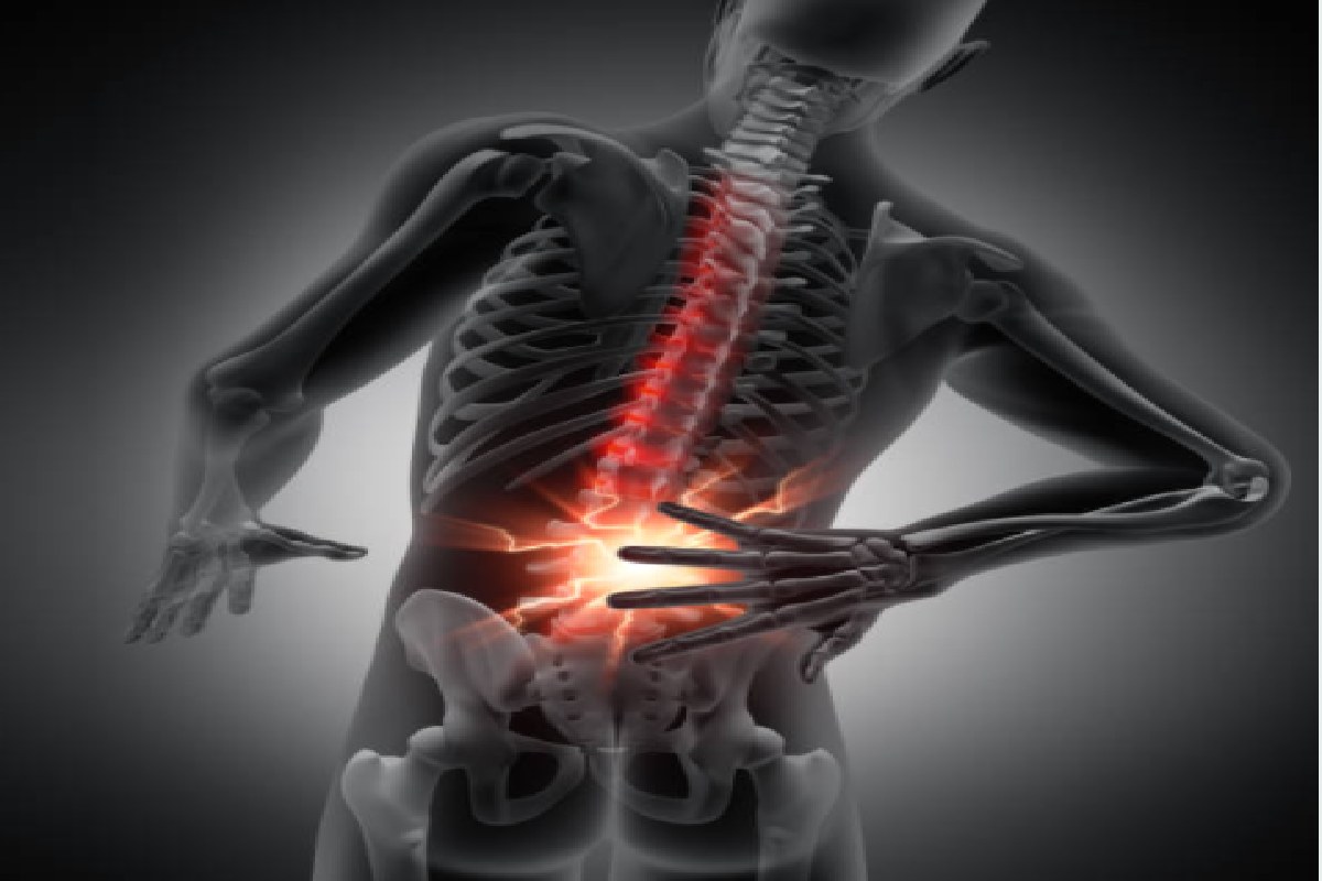 What Is Herniated Discs