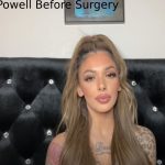 celina powell before surgery