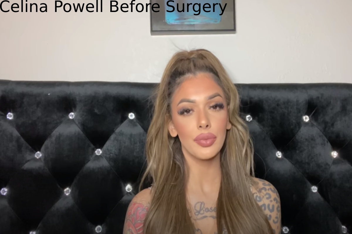 celina powell before surgery