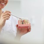 Choosing a Dentist for Dental Implants