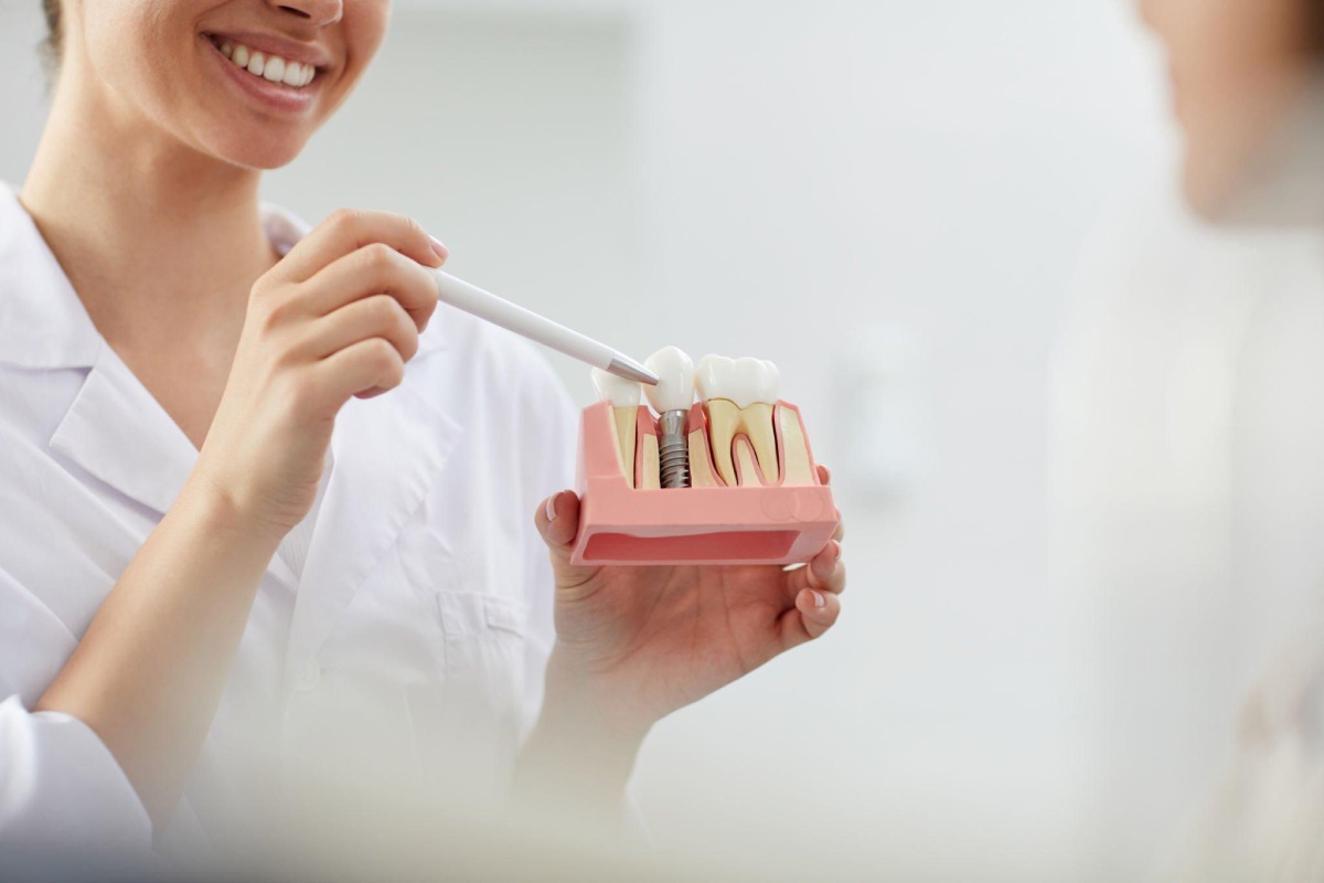 Choosing a Dentist for Dental Implants