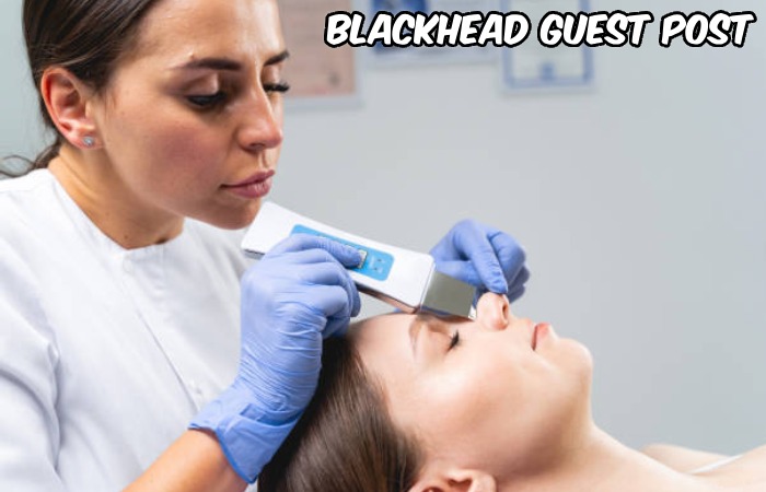 Blackhead Guest Post