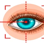 A Comprehensive Guide to Eyelid Surgery