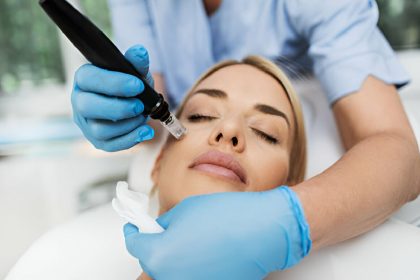 Microneedling Treatment