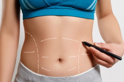 Body Contouring Surgery