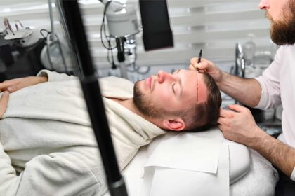 Hair Transplant Success